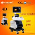 2017 vente chaude 4d échographie doppler couleur avec fonction CW